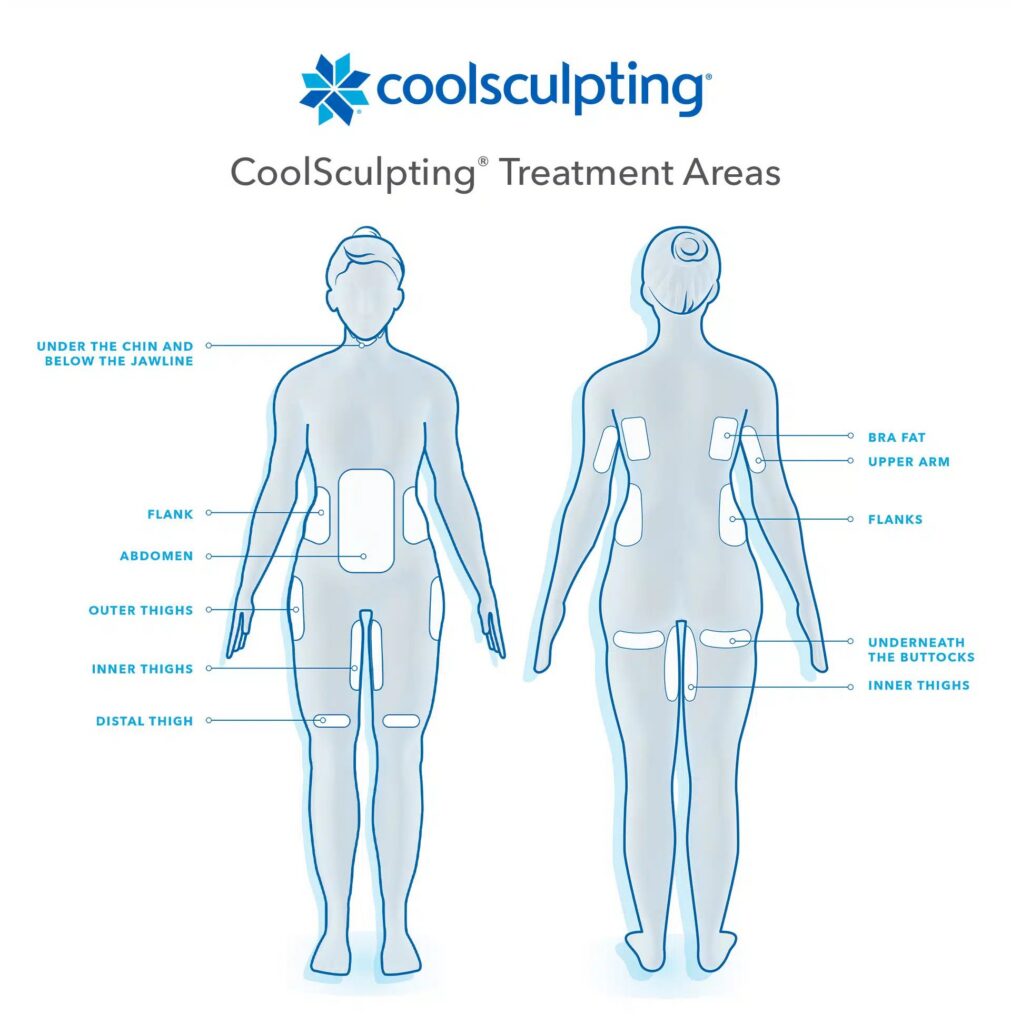 CoolSculpting-Treatment-Areas