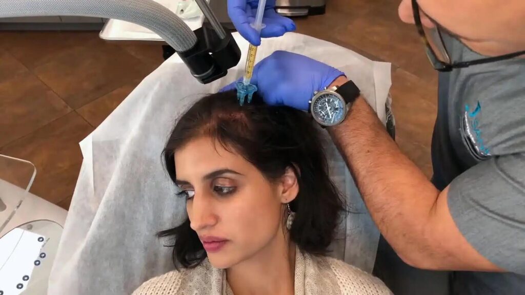 Non Surgical Hair Restoration