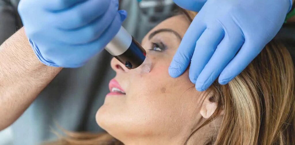 Skin Discoloration, Age-Spots