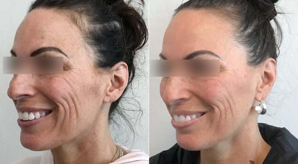 Skinvive Before After 2