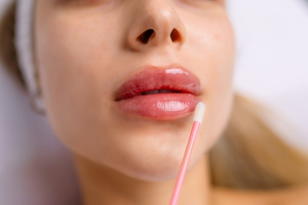 Injection procedure for lip augmentation, close-up