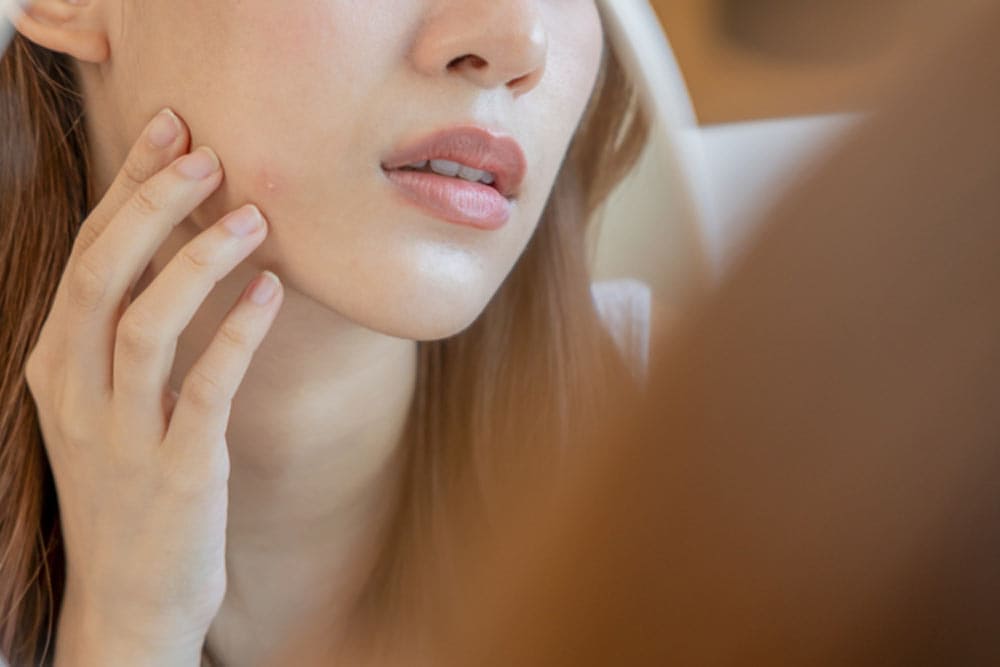 woman asian are worried about faces Dermatology and allergic to steroids in cosmetics
