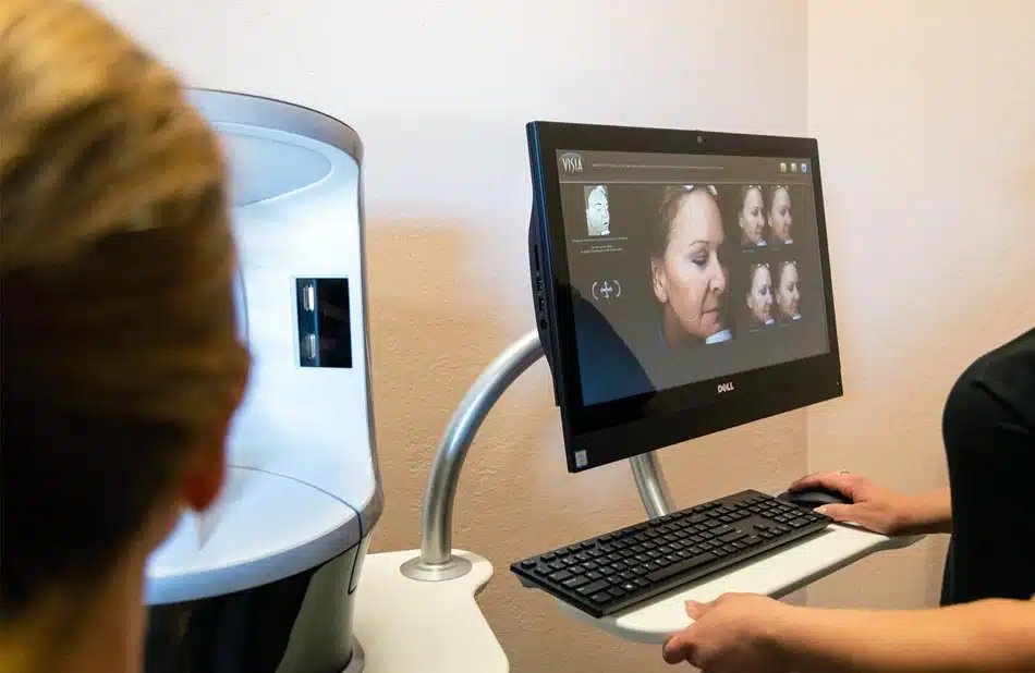 Visia Photo Skin Analysis