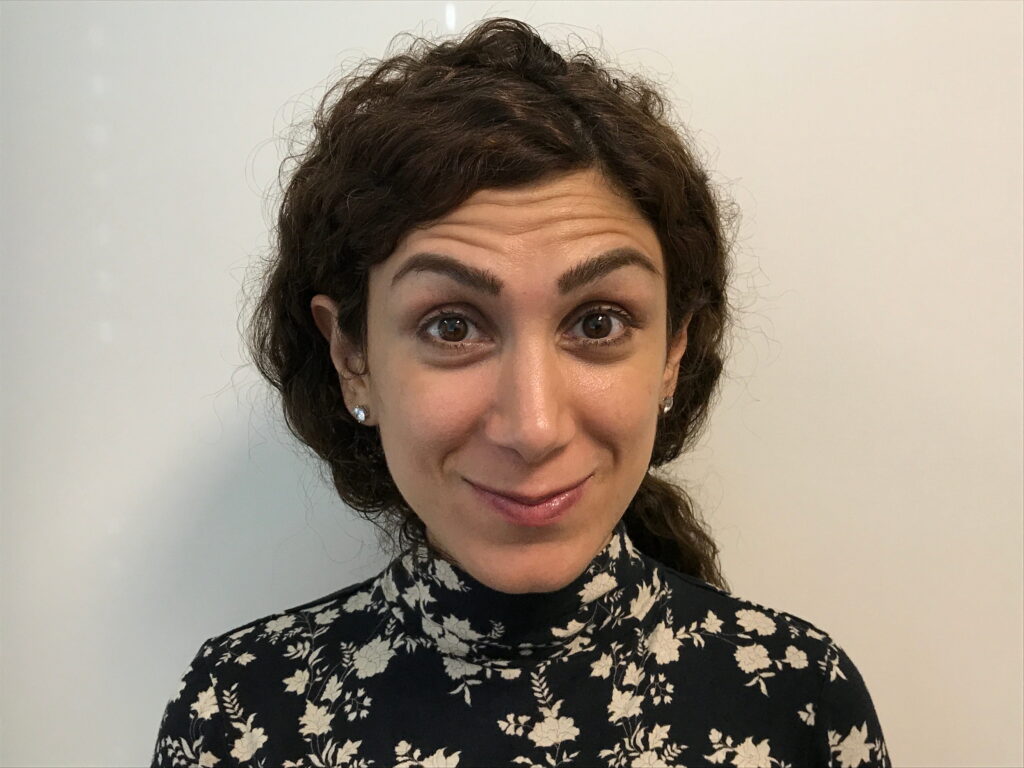Botox Cosmetic After