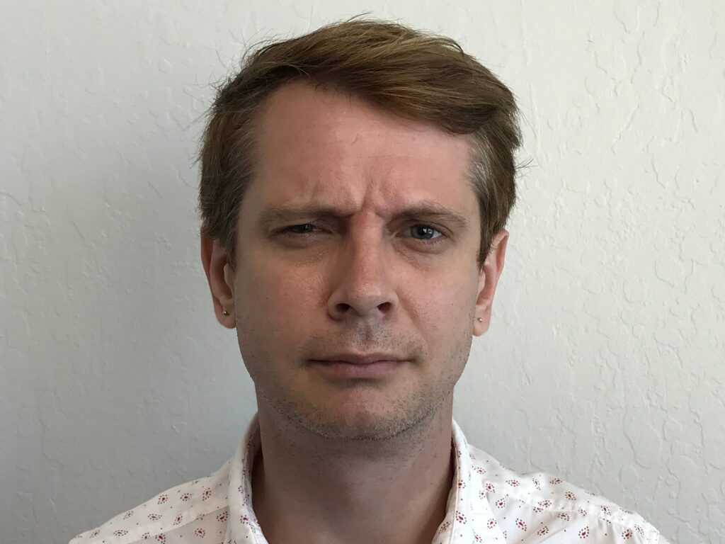 Botox Cosmetic After