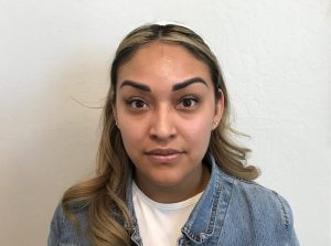 Botox Cosmetic Before