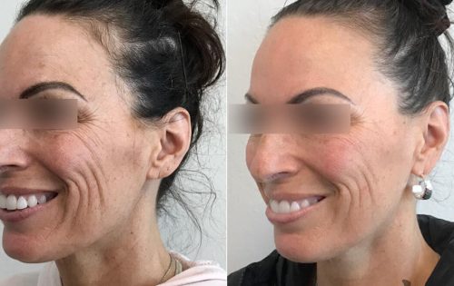 Skinvive Before After 2